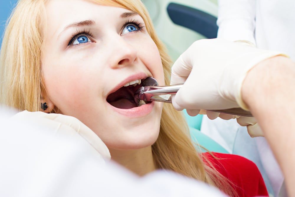 Emergency Dentist for tooth extraction in Johns Creek